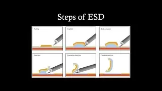 ESD - Principles & Technique (Part I)