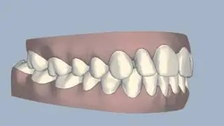 Ringwood Dental