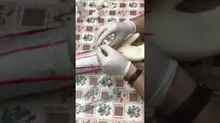 تركيب الكانيولا بطريقة بسيطة مع أهم الأخطاء الشائعة