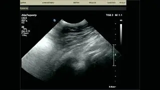 V 20250811 025138