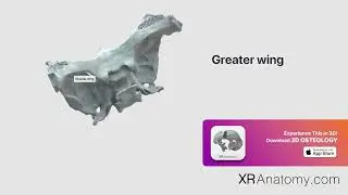 Greater wing of sphenoid bone