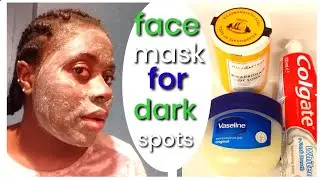 how to remove dark spot & black spot on your face |  applied Vaseline and toothpaste on your face |