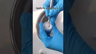 d pulp #shortsviral #shortvideo #shorts #dentist #shortsindia #bollywood #bollywoodsongs #fun #life