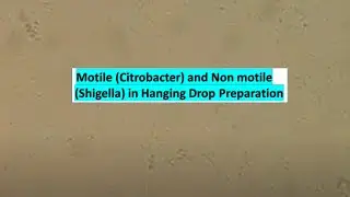 Motile (Citrobacter) and Non motile ( Shigella) in Hanging Drop Preparation