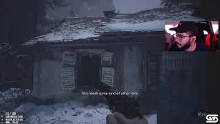 Retro will never stop his teeth fetish