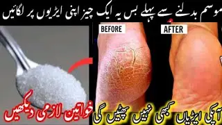 Winter Special Hands Whitening  Cream | Get Soft Smooth Fair| Beautiful Hands In 7 Days |