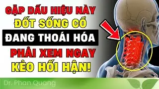 🔴 CẢNH BÁO! 7 Dấu Hiệu THOÁI HÓA CỘT SỐNG CỔ 