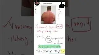Red man syndrome #immunology #uworld #usmlestep1 #usmlestep2ck #shorts