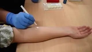Stratum corneum tape stripping