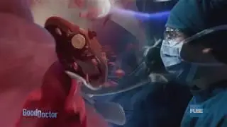 FuseFX: The Good Doctor (VFX) Shaun's Visions