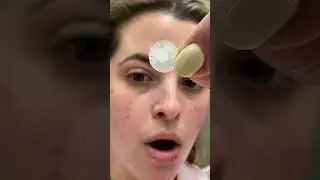 Shirel shares her secret to quickly healing her cold sore in just 5 days using Lip Clear  #coldsore