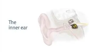 Normal Hearing