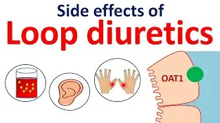 Loop diuretics side effects in easy way | Furosemide, bumetanide, torsemide