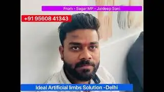 Nakli Tangl l Nakli Per l ArtificialLeg l best artificial limb clinic in india l