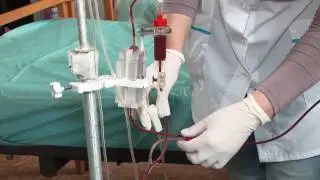 Society for the Advancement of Blood Management (Donate Today!) | SABM