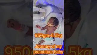 Journey of my premature baby .#trendingnow #viralnow #babyvideos #prematurebaby #pregnancyjourney