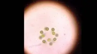 Gorgeous Pond Water Discovery Under Microscope