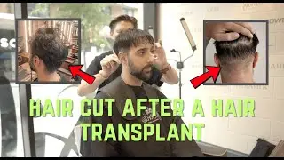 Cutting my Hair After 2 Hair Transplants (10k Grafts)