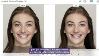 LATAM - iTero Element&trade; 5D Plus: IOSIM Pro