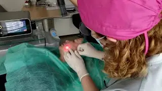 Endolift - zabieg z użyciem Eufoton LASEmaR 1500 L (Klinika Estetica Nova)