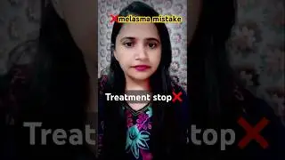 Biggest Melasma Mistake | Treatment Beech Mein Chhodna ❌