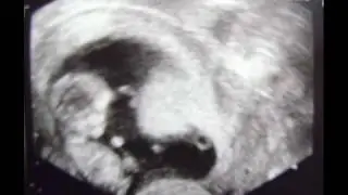 L'histoire de la cr&eacute;ation de mon mini-moi