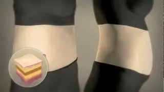 How Liposonix Works - Non Surgical Body Contouring - Liposonix Florida