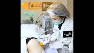 Thermage FLX Body