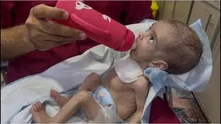  Tiny Fighter: A Little Baby Covered in Wires but Full of Strength! 💪👶