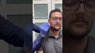 TMJ dry needling! #asmrsounds #asmrcommunity #asmrvideo #chiropracticadjustment