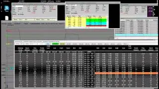 Options Call vs Puts ISRG Earnings Miss Down $20 Options Friday Expiration