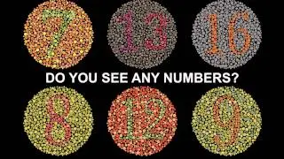 Sample Video ~ Optometrist Educational Promo Video | Color Blindness