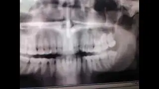 20130801 114129