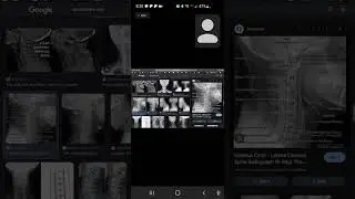 Ryan Aleckszander zoom Chiropractor