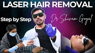 Second Laser Hair Removal Treatment | Laser Hair Removal Process, Safety & Results | Dr Shivam Goyal