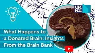 What Happens to a Donated Brain | Insights From the South West Dementia Brain Bank