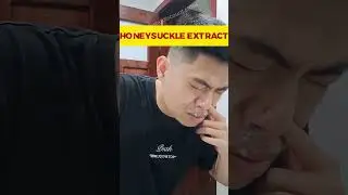 Solusi Radikal Sinusitis: Hilangkan Gejala dengan Oga Max Plus!