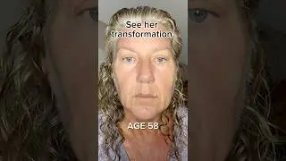 Face Transformation | Face Fitness | Face Yoga | Face Massage