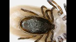 Deer Ticks Mating Under Microscope -