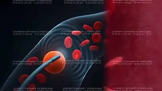 AI Medical Animation CHRISTOPHER.C