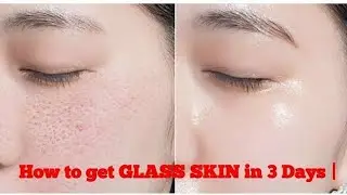 🔥JUST in 2 USES Remove Clogged Pores, Blackheads, Bumps, Whiteheads & Large Pores|Deep pore cleaning