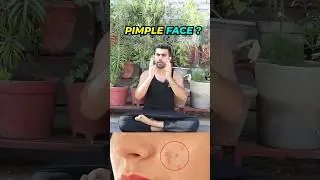 Pimple on face ? | remove it easily in 2 min #face #yoga