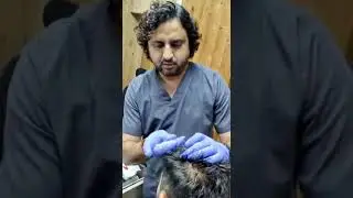PRP Hair Treatment Injections for Hair Loss | Dr. HS Chauhan Twacha Dermatology Clinic Meerut Bijnor
