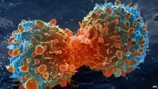 Cancer Causes: Genetics vs Environment