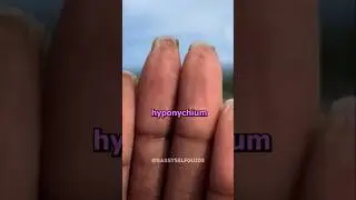 Уникальное состояние ногтей 🤯