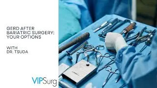 How to Treat GERD After Sleeve Gastrectomy | Surgical Options Explained