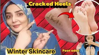 FIX Dry Cracked Heels Overnight With BEST Foot Cream!||Winter skincare essentials||Foot odor removal
