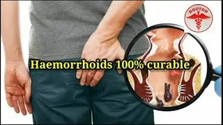 Haemorrhoids / Piles Allopathic Treatment | Best medicines | instant relief👍