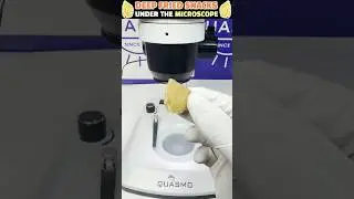 Deep Fried Snacks🍟Under The Microscope🔬 | Live Results #shorts #friedfood #snackfoodies
