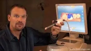Omnicam Introduction Ehrlich